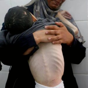 bir yanda katliam bir yanda aclik gazzede can kaybi 61 bin 430 oldu rtP71VU7