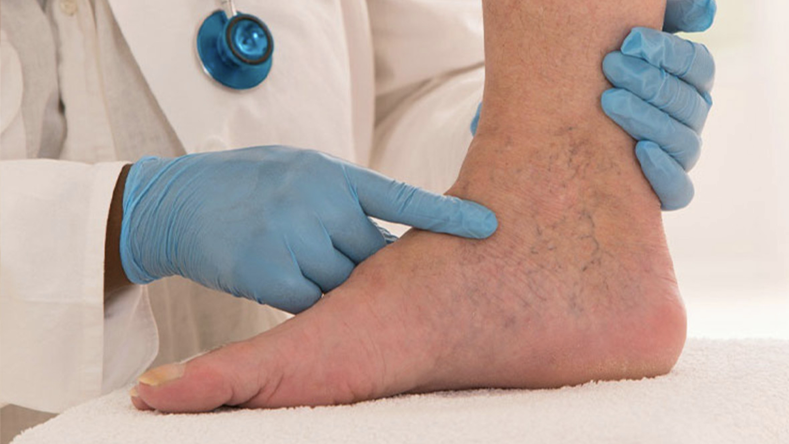 bacakta sislik ve agri hissedenler dikkat derin ven trombozunun isaretcisi olabilir yYhzTqTk